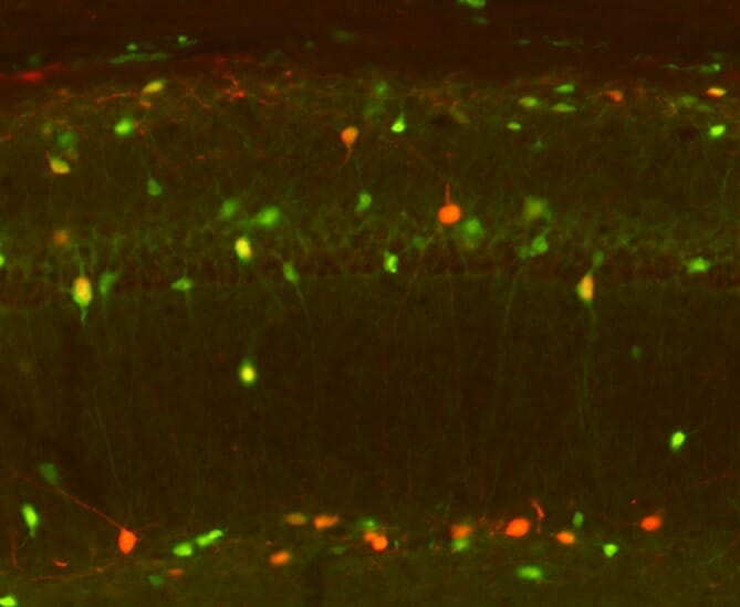 Hipocampo de un ratón Dravet