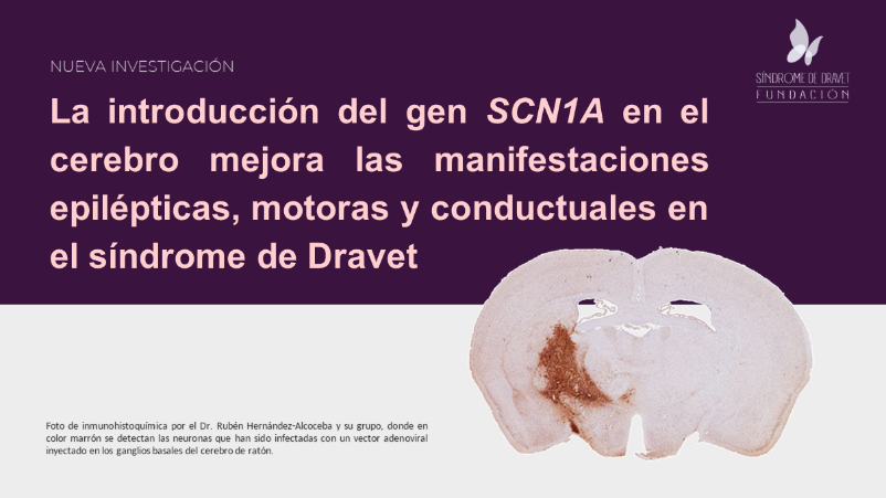 Introducción gen SCN1A