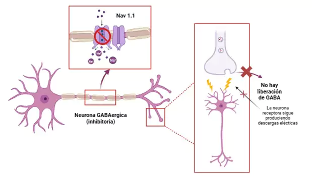 Disfunción de las neuronas alteradas